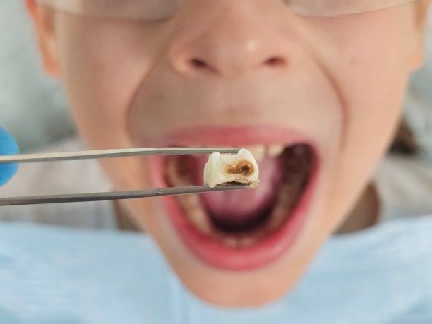 Best Emergency Pediatric Dental Care in Johnstown, NY